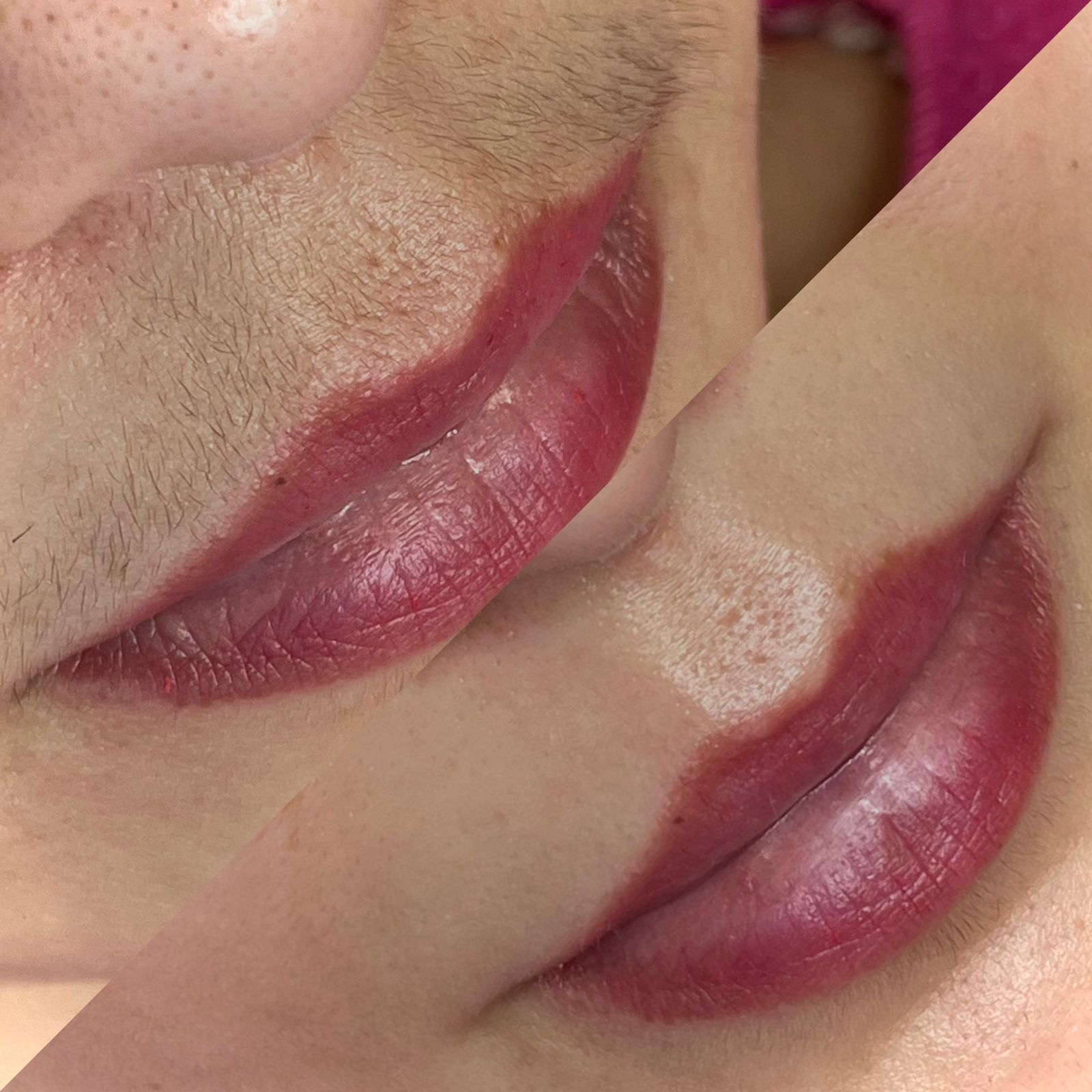 Epilação de Buço Pacote Imagem